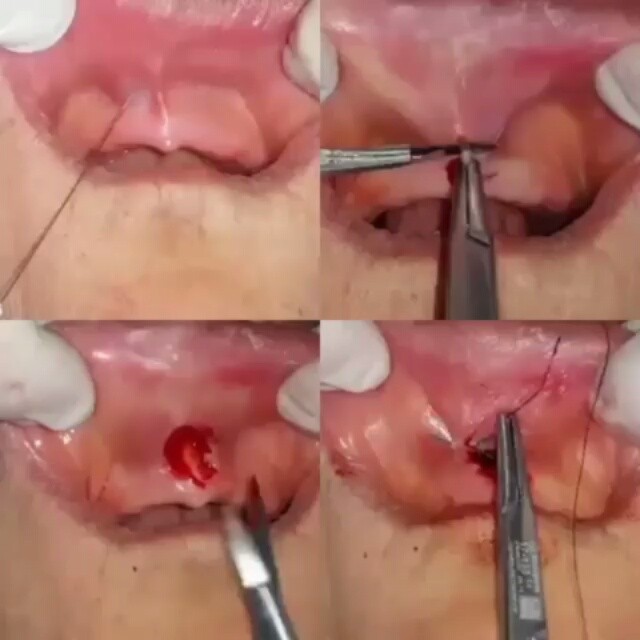 12523805_1194356577259320_393373057_n