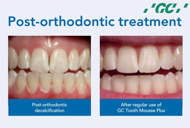 4123206d4f671eec57f8a031f11edea5