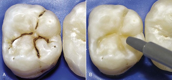 B9780323075886000098_f009-022-97803230758861